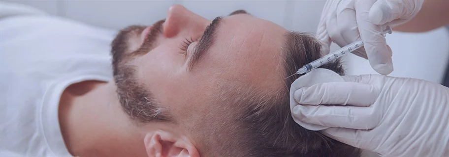 Platelet-Rich-Plasma-PRP-Therapy-for-Hair-Loss-in-Turkey