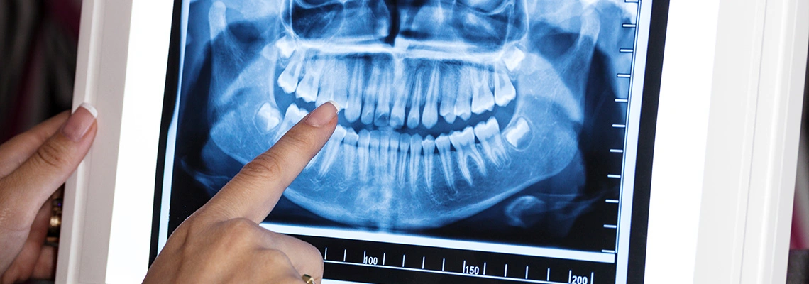 Digital Smile Design (DSD) in Turkey: Preview Your New Smile Before Treatment