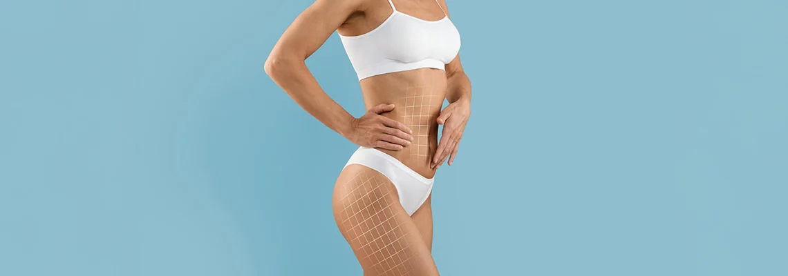 best-vaser-liposuction-in-turkey-cost-recovery-stunning-before-after-results