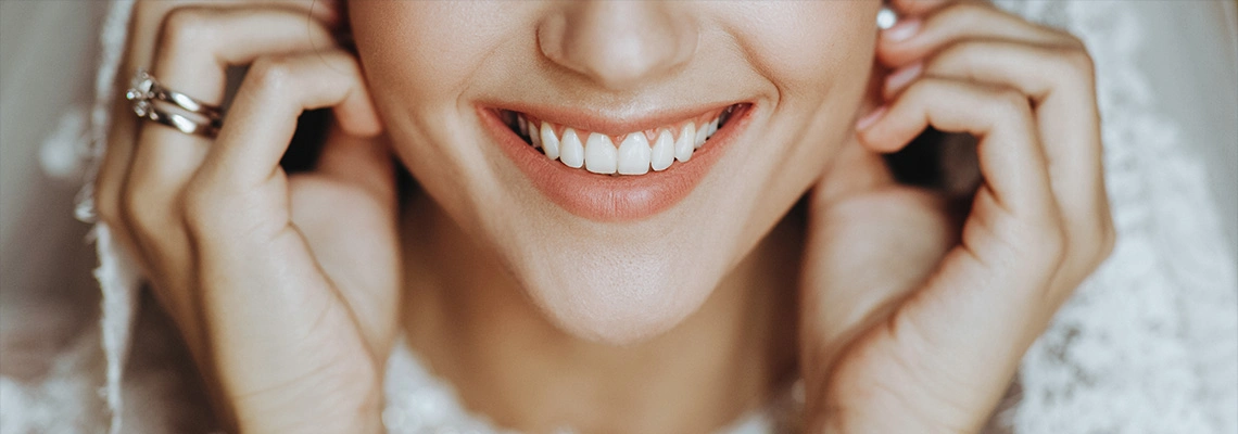 Hollywood Smile for Brides & Grooms: Wedding-Ready Smiles in Just One Trip to Turkey