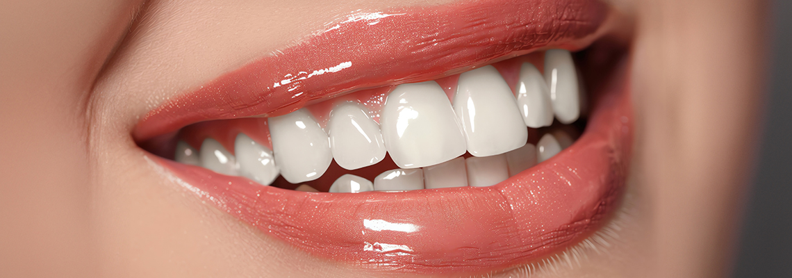 2 Powerful methods to improve front teeth appearance: Veneers & crowns 